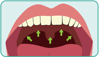 mouth swab image