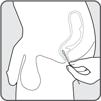 insert into rectum image