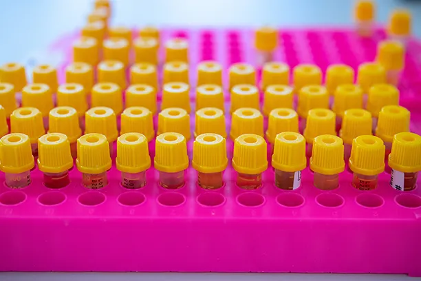 blood STI testing tube samples for hepatitis B screening