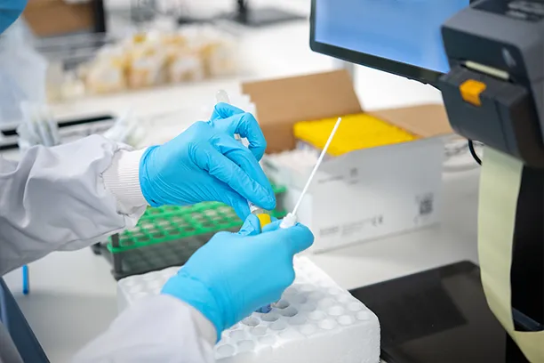 testing vaginal swab sample for Gonorrhoea testing in laboratory